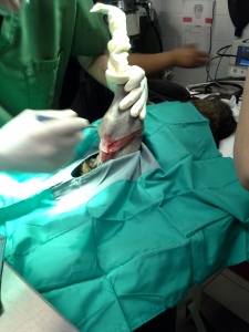 Using a scalpel to cut through to bone joint