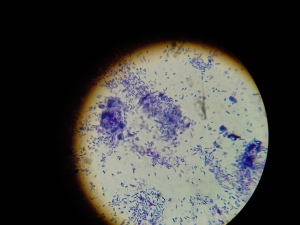 Bacteria infection from ear swab.